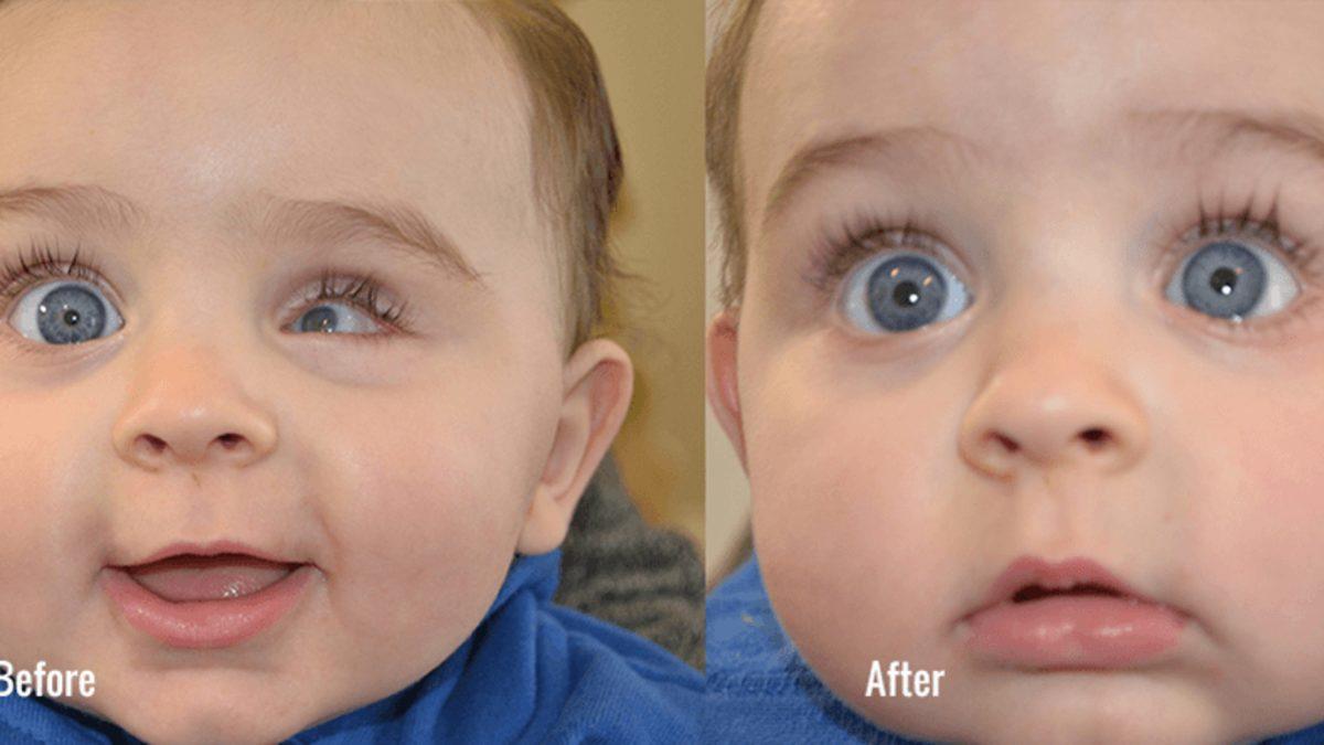 Kişinin Hayatını Değiştiren 8 Mucize Protez Buluşu