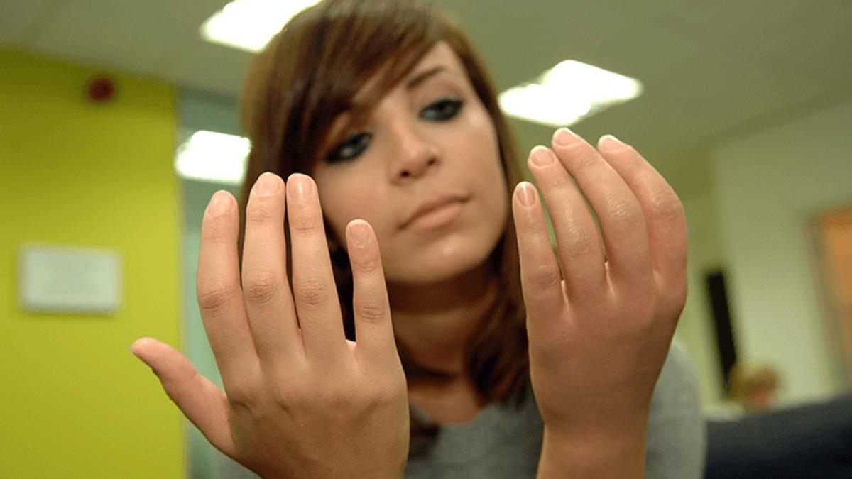 Kişinin Hayatını Değiştiren 8 Mucize Protez Buluşu