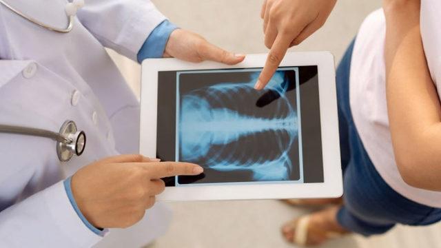 Savunma Sanayii Başkanı: Yakında Mobil Dijital Röntgen Cihazı Devreye Girecek