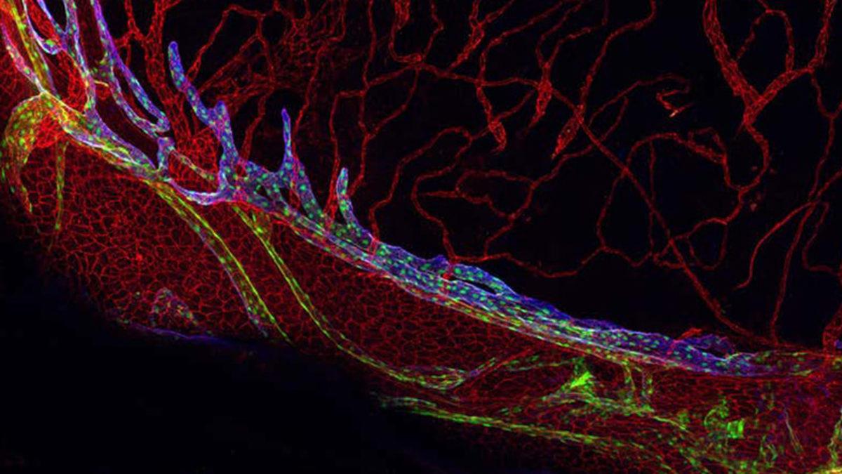 Alzheimer’ın Tedavisini Mümkün Kılabilecek Bir Keşif Yapıldı