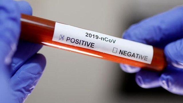 Koronavirüs Vaka Sayısı Sıfıra İnen İllerde Tersine Karantina Uygulanabilir