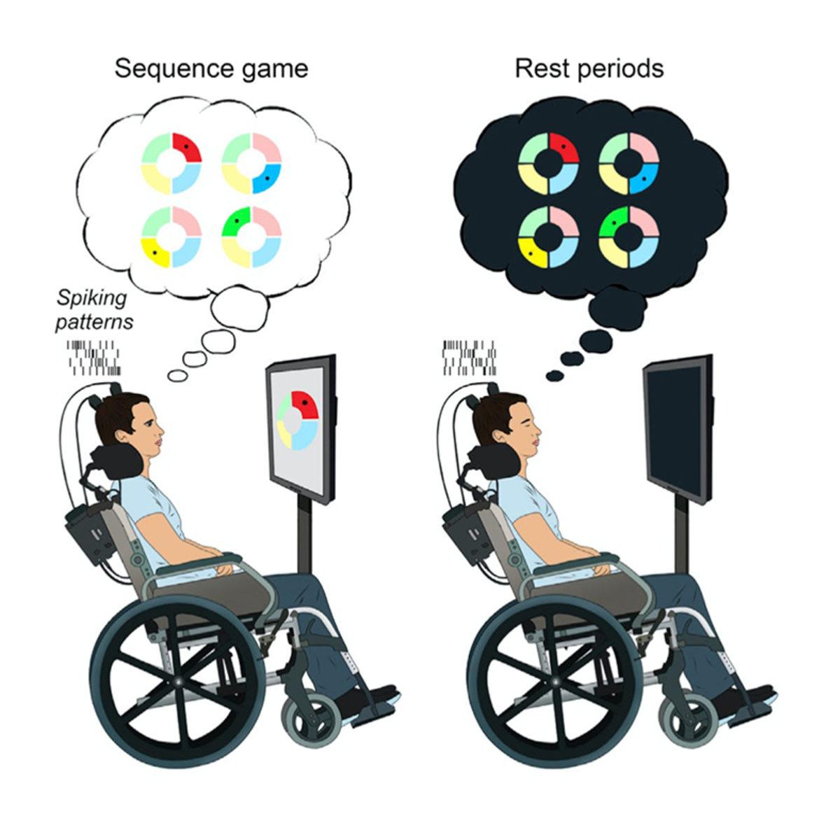 Bilim İnsanları, Beynin Uyku Sırasında Anıları Nasıl Kaydettiğini Ortaya Çıkardı