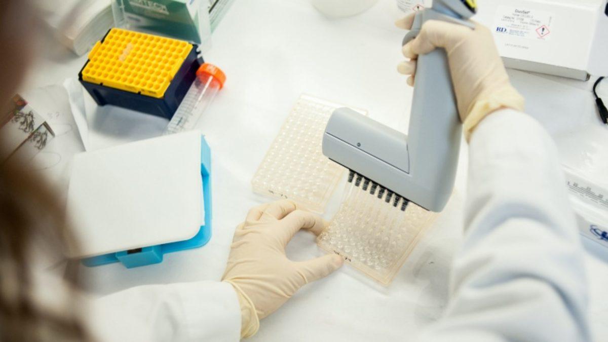 Sağlık Bakanlığı, Belirti Göstermeyen Vakaların Tespiti İçin Elisa Testleri Yapacak