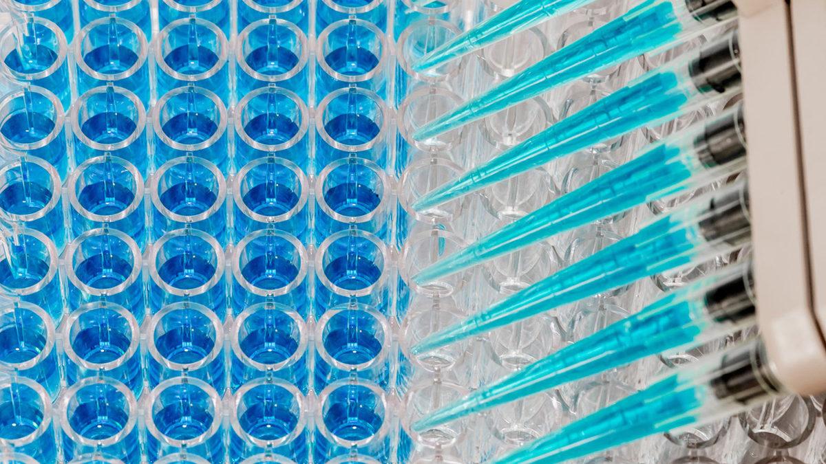 Elisa Testi Nedir? Belirti Göstermeyen Koronavirüs Vakaları Nasıl Tespit Edilecek?