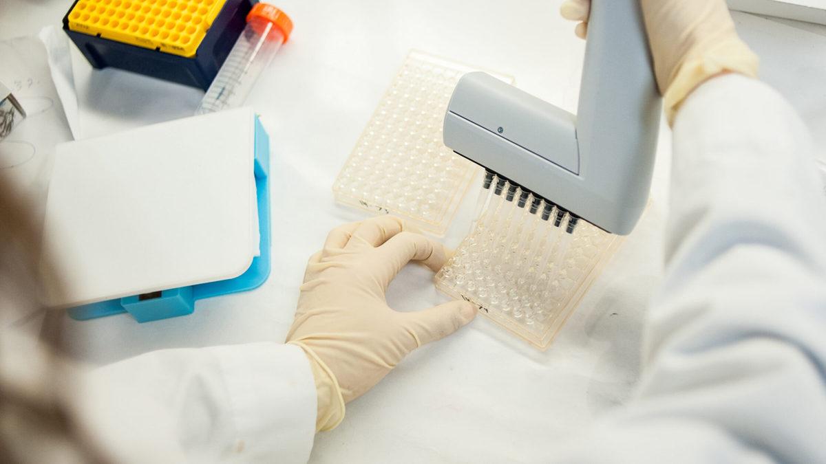 Elisa Testi Nedir? Belirti Göstermeyen Koronavirüs Vakaları Nasıl Tespit Edilecek?