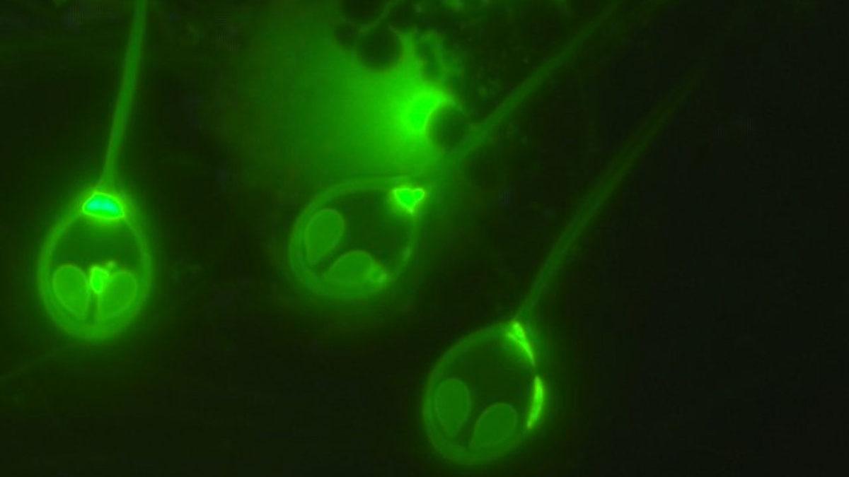 Araştırmacılar, Oksijene İhtiyaç Duymadan Yaşayan İlk Hayvanı Keşfettiler