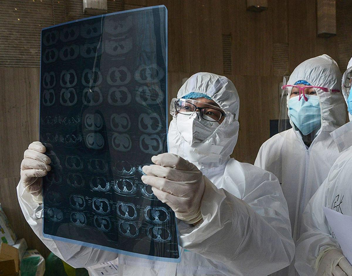 Koronavirüs, Beyinden Ayak Parmaklarına Kadar Tüm Vücudu Etkiliyor