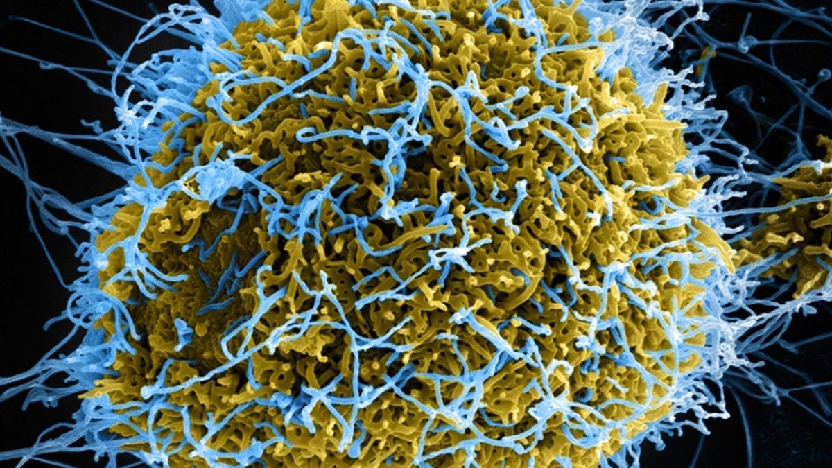 Diğerlerinden 10 Kat Büyük Olan Dev Virüslerin Nasıl Bulaştığı Keşfedildi