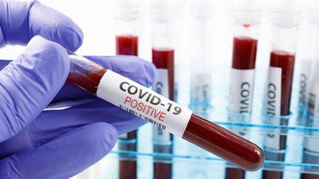 Fransız Akademisi, Covid-19’un ’Cinsiyeti’ni Açıkladı