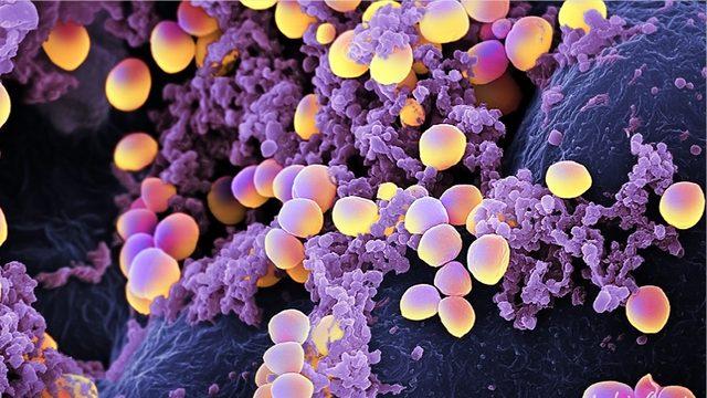 Bilim İnsanları, Antibiyotik Direncini Tarihe Gömecek Bir Formül Geliştirdiler