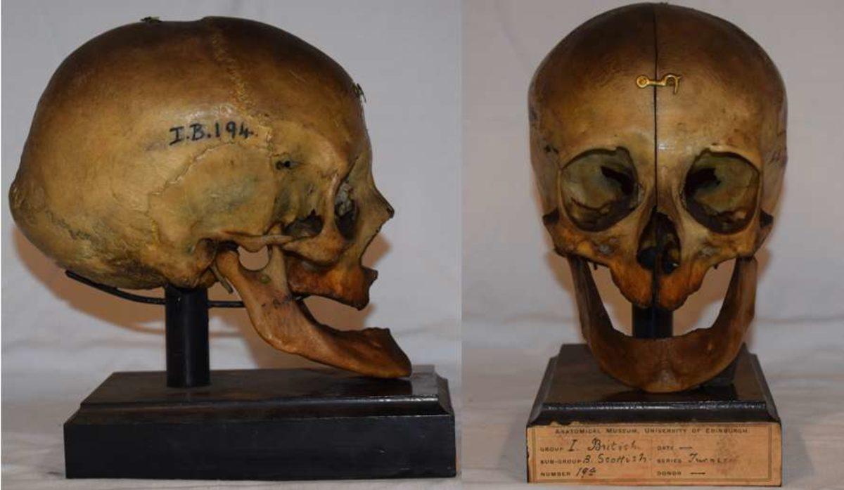 2000 Yıl Önce Yaşamış Dişsiz Bir Kadının Yüzü Yeniden Oluşturuldu