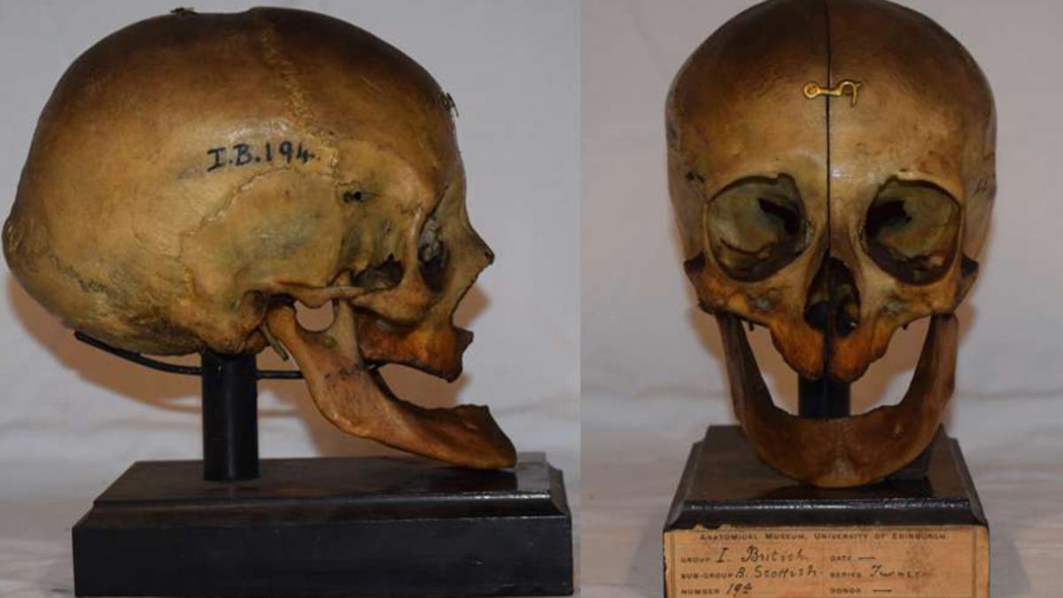 2000 Yıl Önce Yaşamış Dişsiz Bir Kadının Yüzü Yeniden Oluşturuldu