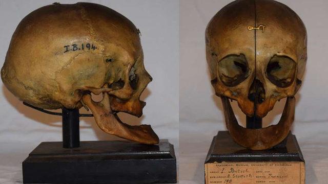 2000 Yıl Önce Yaşamış Dişsiz Bir Kadının Yüzü Yeniden Oluşturuldu