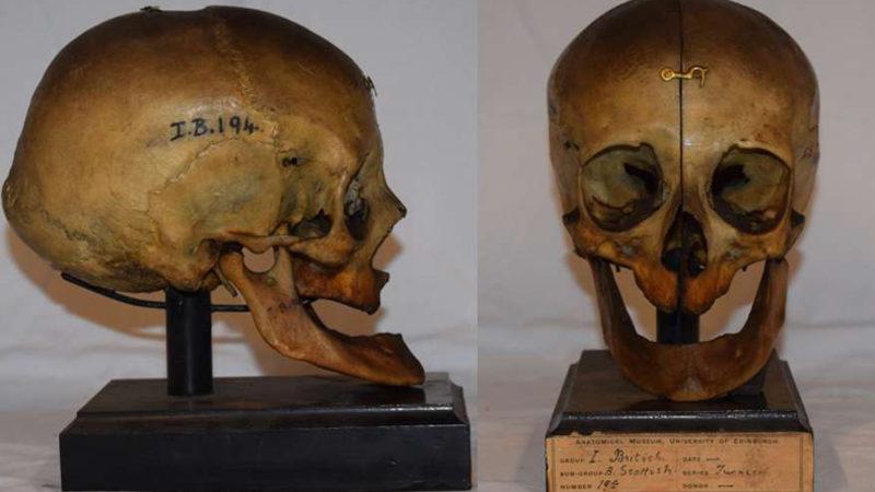 2000 Yıl Önce Yaşamış Dişsiz Bir Kadının Yüzü Yeniden Oluşturuldu