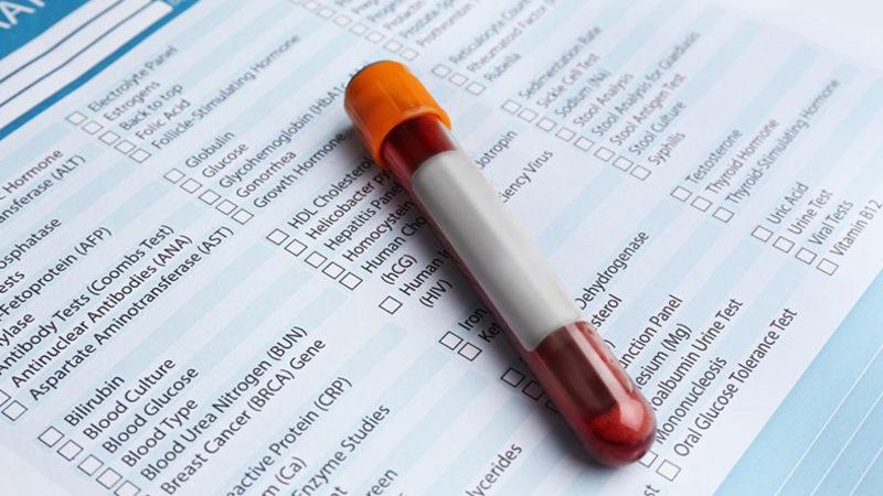 Kan Testi ile 5-10 Sene İçerisinde Ölüp Ölmeyeceğimizi Öğrenebileceğiz