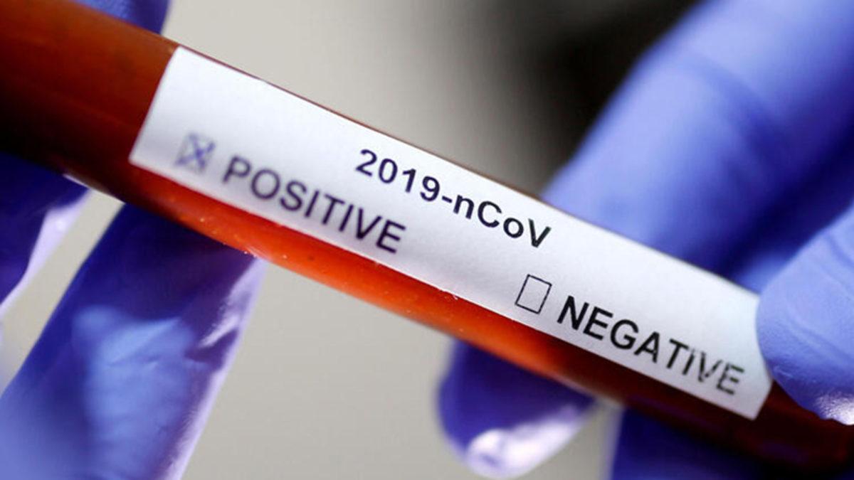 Koronavirüsü Atlatan Bir Sağlıkçının 6 Haftada Yaşadığı Akılalmaz Değişim