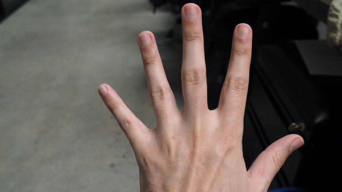 Evrimsel Biyoloji Uzmanı: Yüzük Parmağı Uzun Erkeklerin COVID-19’dan Ölme Riski Daha Az