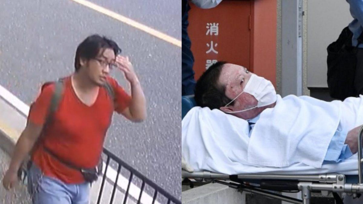 Japon Animasyon Stüdyosunu Kundaklayıp 36 Kişiyi Öldüren Saldırgan, Tedavisinin Ardından Tutuklandı