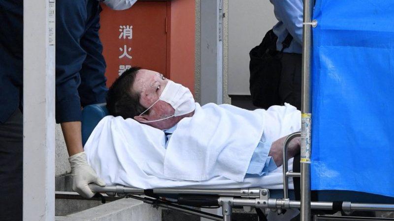 Japon Animasyon Stüdyosunu Kundaklayıp 36 Kişiyi Öldüren Saldırgan, Tedavisinin Ardından Tutuklandı