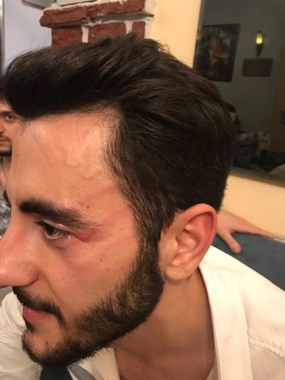 Gazetecilere Saldıran Reynmen, Gözaltına Alındı