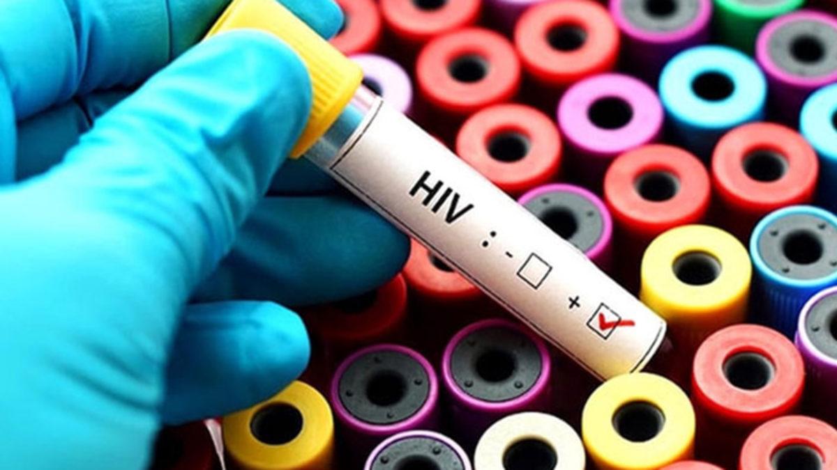 Bilim İnsanlarından Müthiş Başarı: CRISPR ile AIDS Tedavi Edildi