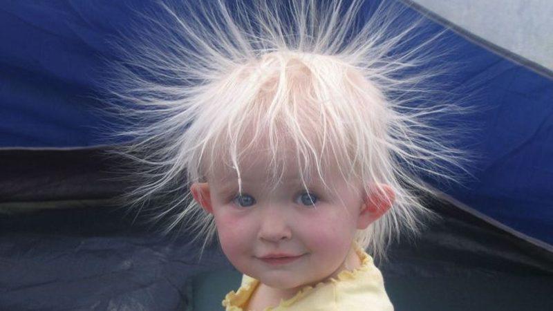 Statik Elektriğin Ardındaki Şok Edici Sır Ortaya Çıktı