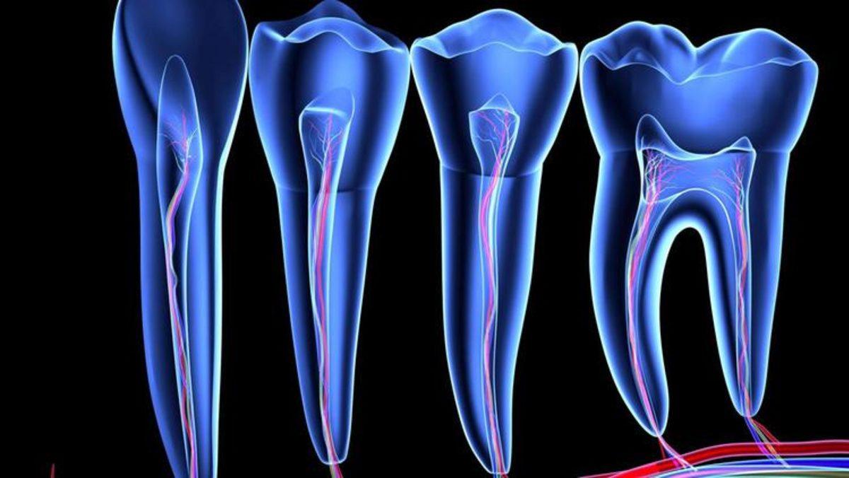 Çinli Bilim İnsanları Diş Çürümesini Ortadan Kaldırmayı Başardı