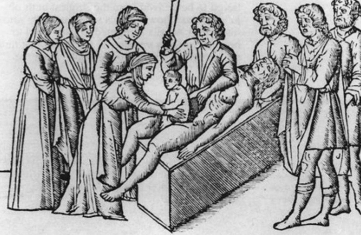 Jül Sezar, Neden Sezaryen Doğuma Adını Verdi?