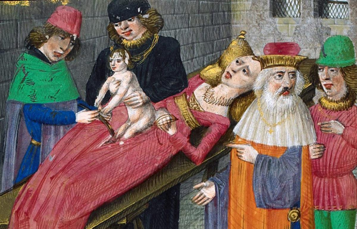 Jül Sezar, Neden Sezaryen Doğuma Adını Verdi?