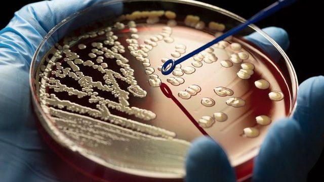 Rusya’nın Virüs Örneklerini Sakladığı Tesiste Patlama Oldu