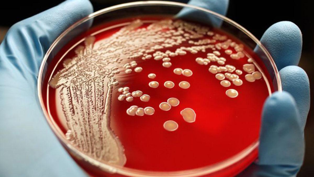 Araştırmalara Göre Bazı İnsanlar, MRSA’ya Karşı Genetik Korumaya Sahip