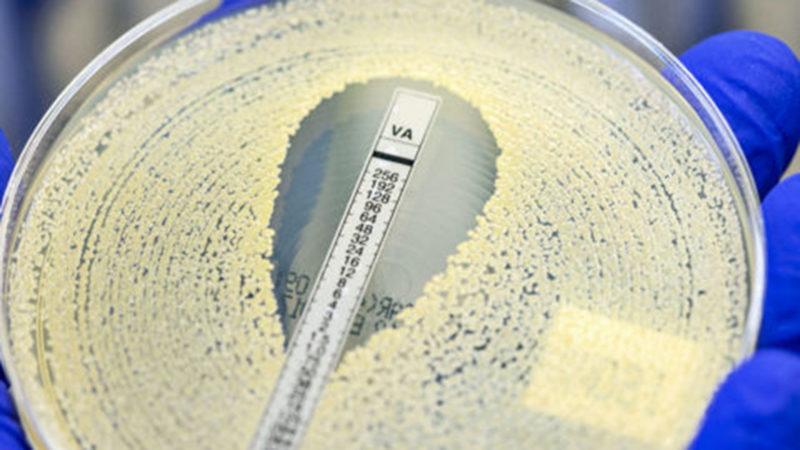 Araştırmalara Göre Bazı İnsanlar, MRSA’ya Karşı Genetik Korumaya Sahip