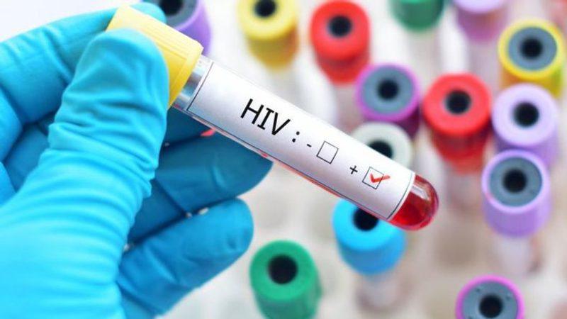 HIV Hücrelerinin Çoğalmasını Durdurmanın Yolu Bulundu