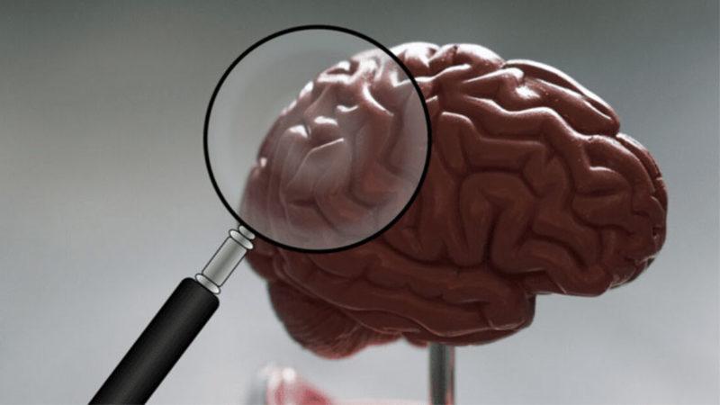 Teknolojinin Kadın ve Erkekleri Neden Farklı Etkilediği Nörolojik Olarak Açıklandı