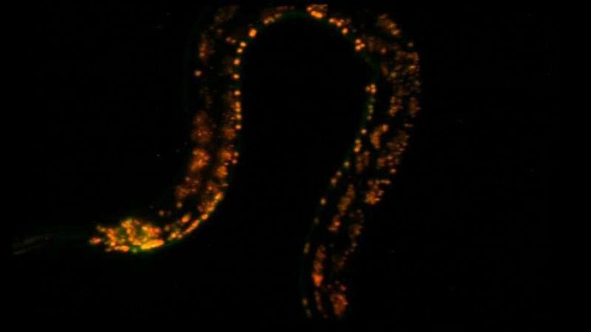 Yüksek Hızda 3 Boyutlu Gözlemler Yapabilen Yeni Nesil Mikroskop: SCAPE 2.0