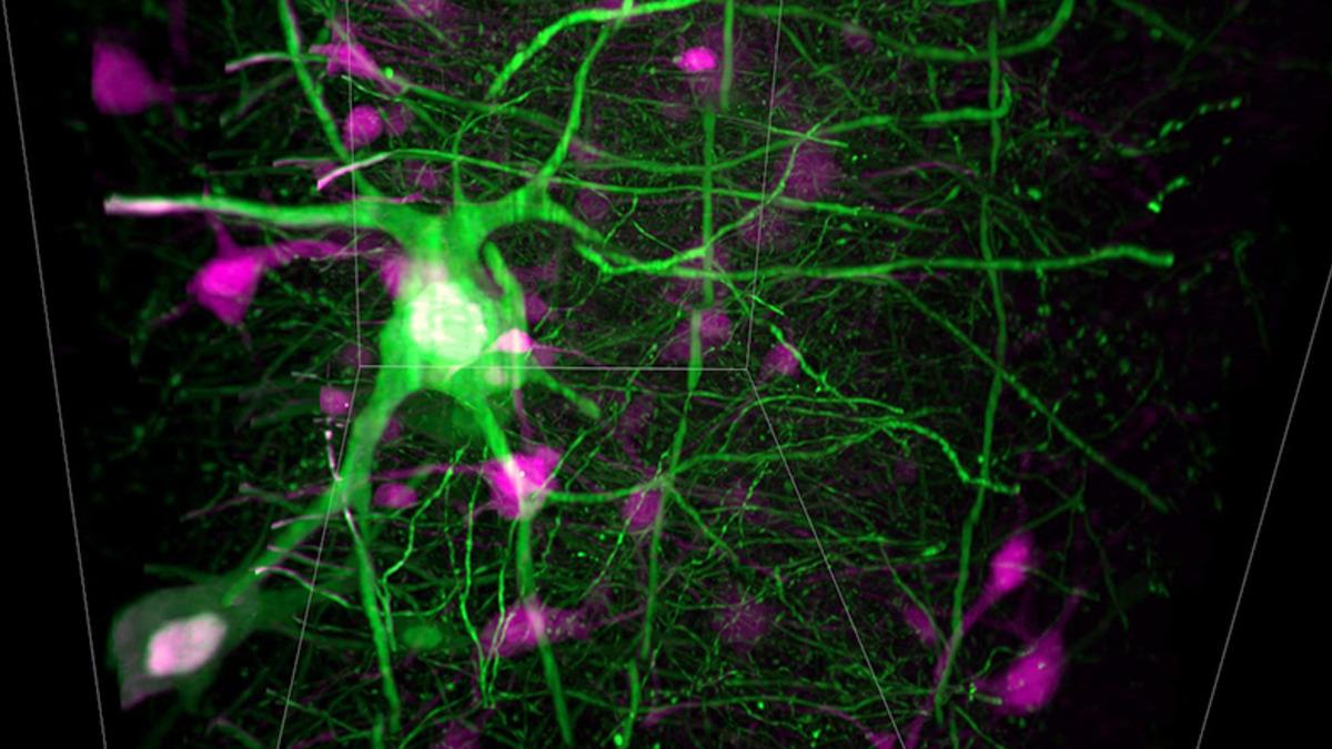 Yüksek Hızda 3 Boyutlu Gözlemler Yapabilen Yeni Nesil Mikroskop: SCAPE 2.0
