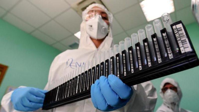 Bir Biyosavunma Uzmanı, ’Koronavirüs Laboratuvardan Çıktı’ İddialarına Yanıt Verdi