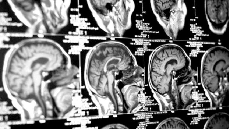 ’0’ ve ’1’ Dışındaki Rakamları ’Bir Tabak Spagetti’ Olarak Algılayan Adamın İlginç Hikâyesi