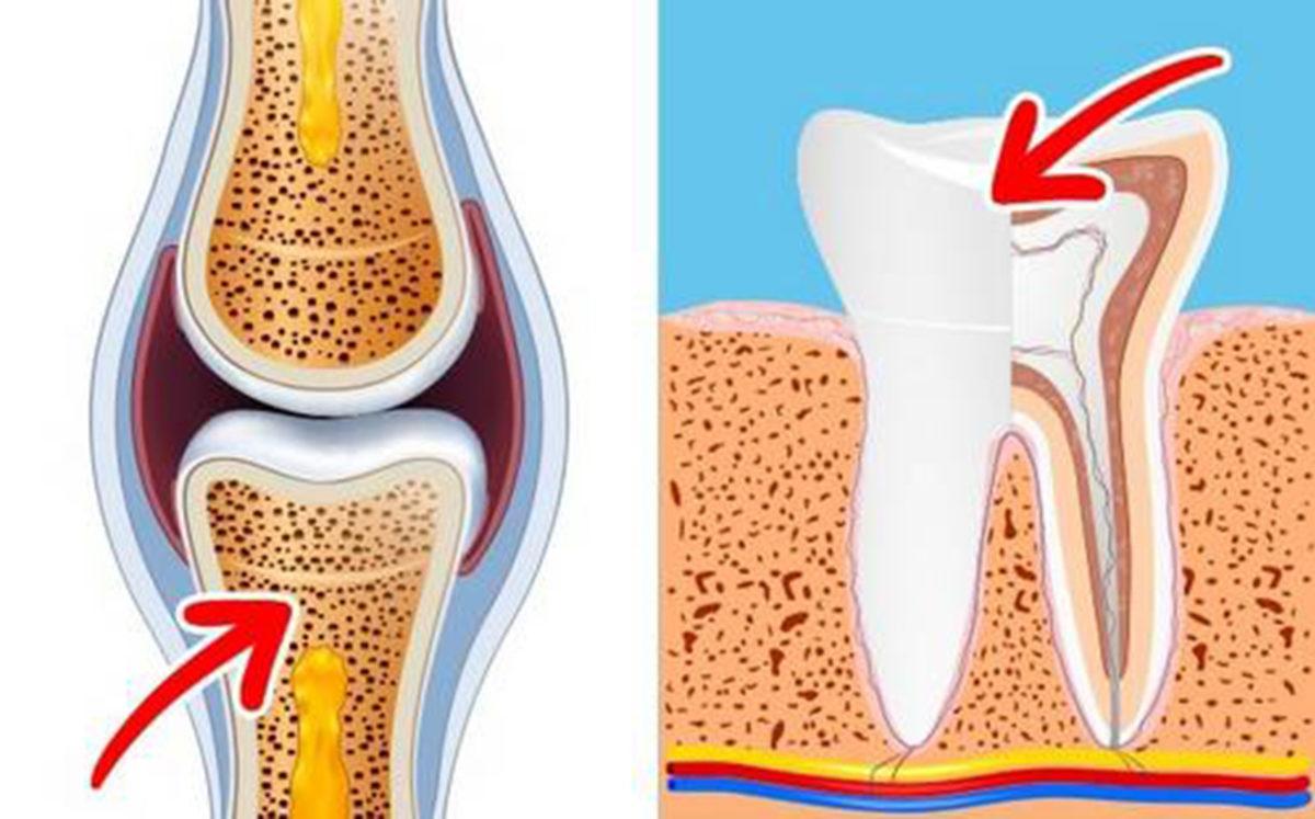 Her Gün 2 Yumurta Yemeye Başlarsanız Vücudunuzda Neler Olur?
