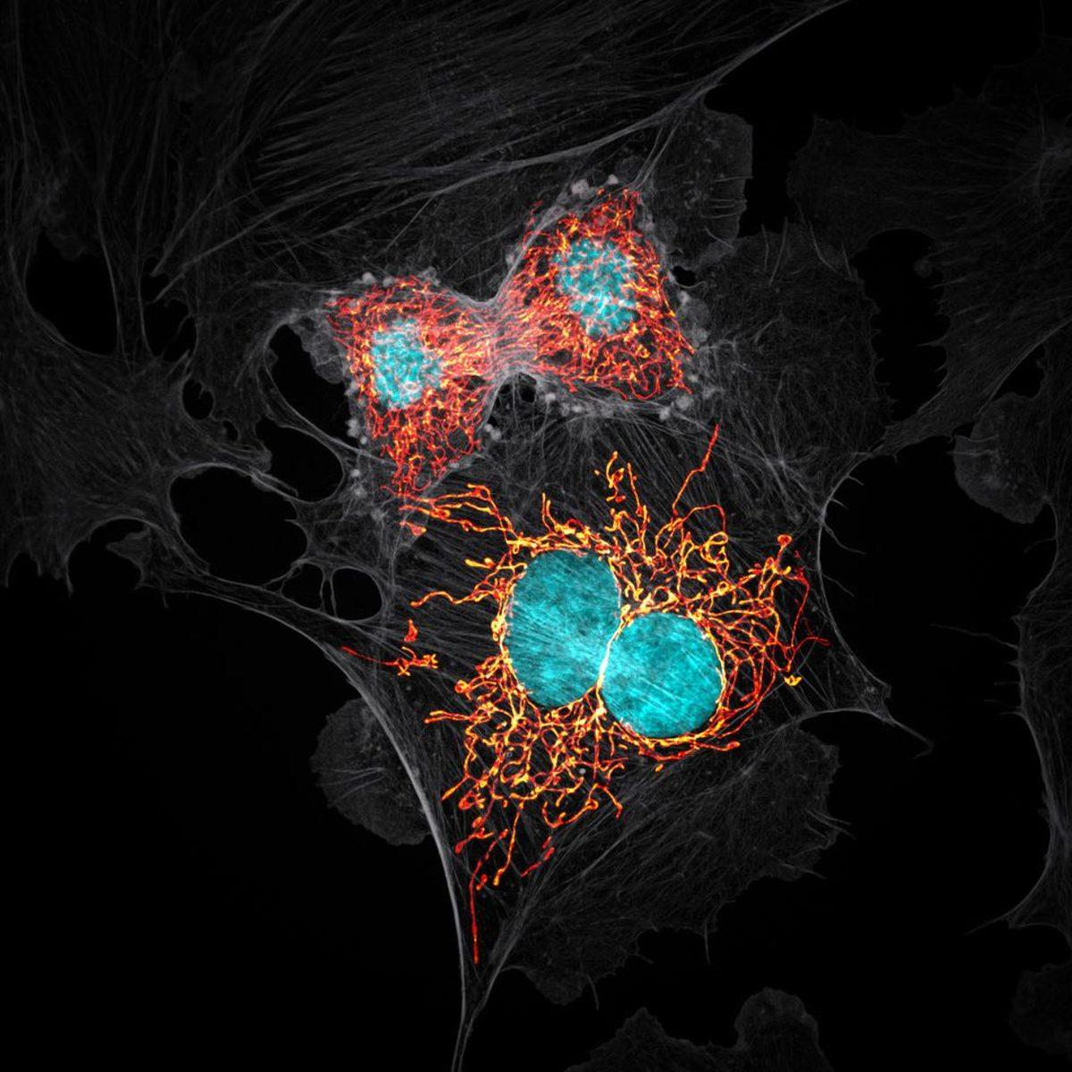 Gördüğünüz Anda Tüylerinizi Ürpertecek 20 Ultra Detaylı Mikroskobik Fotoğraf