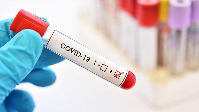 DSÖ, COVID-19 Tedavisinde Hidroksiklorokin ve 2 İlacın Denemelerini Durdurdu