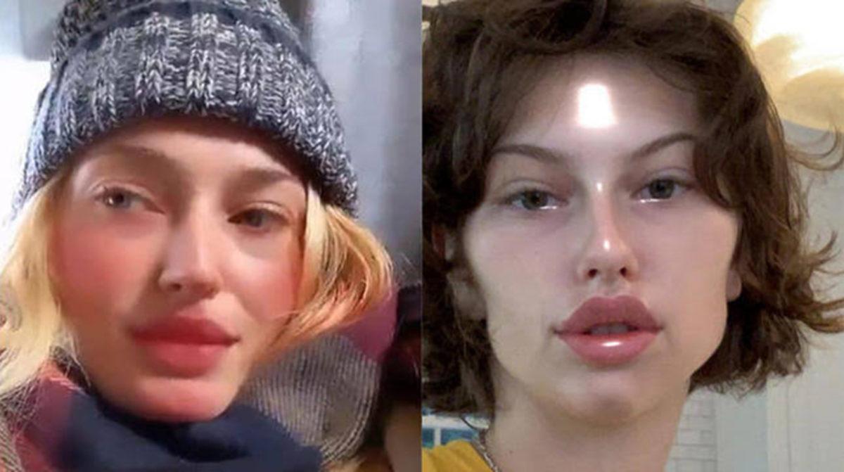 Instagram ’Plastik Cerrahi’ Filtrelerini Yasaklıyor