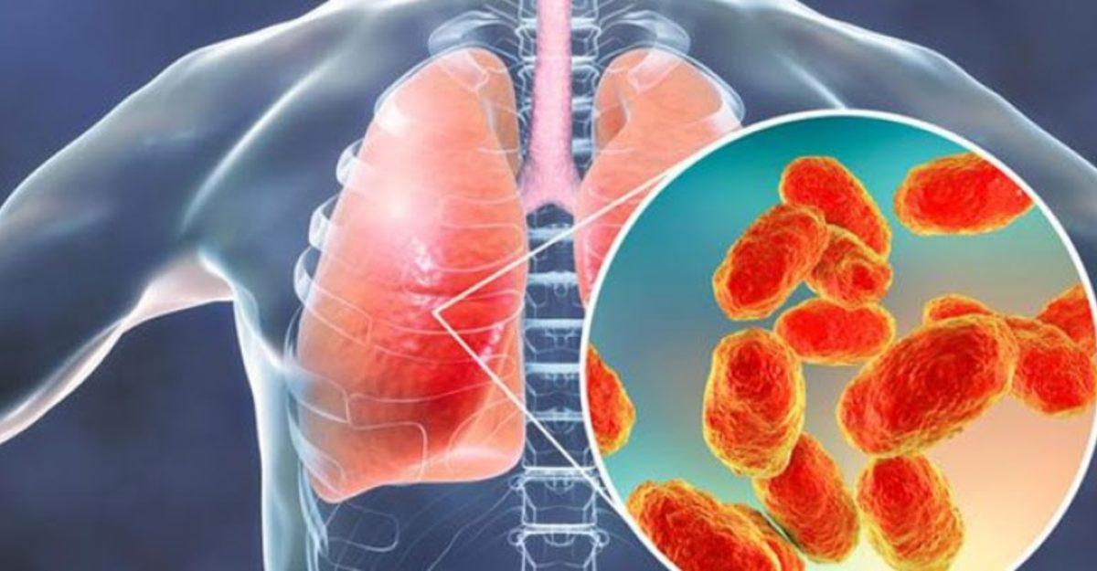 Kazakistan’da Covid-19’dan Daha Ölümcül Bir Hastalığın Görüldüğü Açıklandı