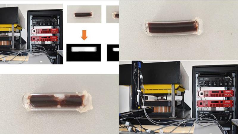 ASELSAN’dan Sağlık Sektöründe Dev Yenilik