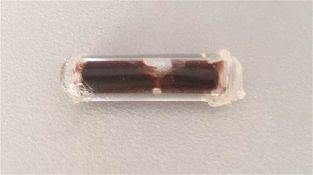 ASELSAN’dan Sağlık Sektöründe Dev Yenilik