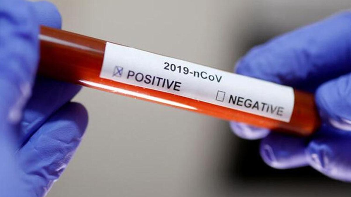 DSÖ, Koronavirüsün Kaynağını Bulmak İçin Çin’e Ekip Gönderdi