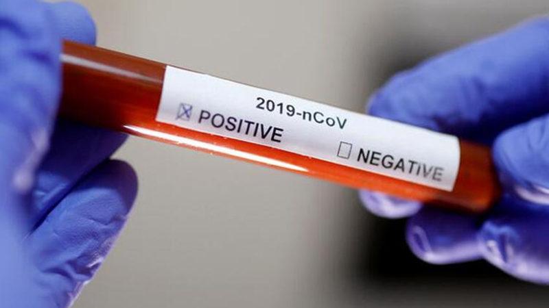 DSÖ Yetkilisi: Mevcut Durumda Koronavirüsü Ortadan Kaldırmak Olası Değil