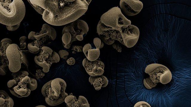 Besin Olarak Metal Yiyen Bir Bakteri Keşfedildi