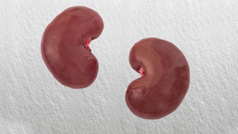 Samsun’da Böbreğini Sosyal Medyadan Satışa Çıkaran Bir Kişi Gözaltına Alındı