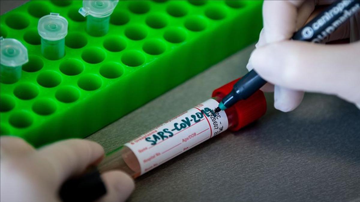 Araştırmacılar, Koronavirüs Belirtilerini 6 Kümeye Ayırdı